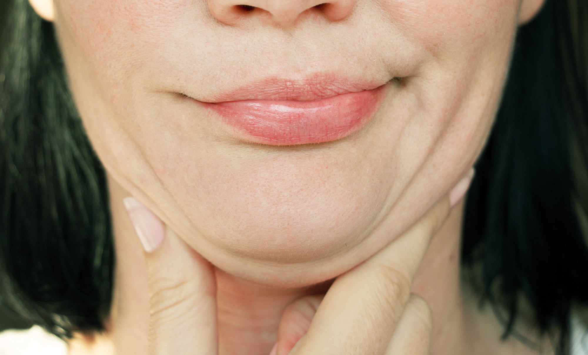 What Causes A Double Chin Causes Treatment Options Atlanta Face 