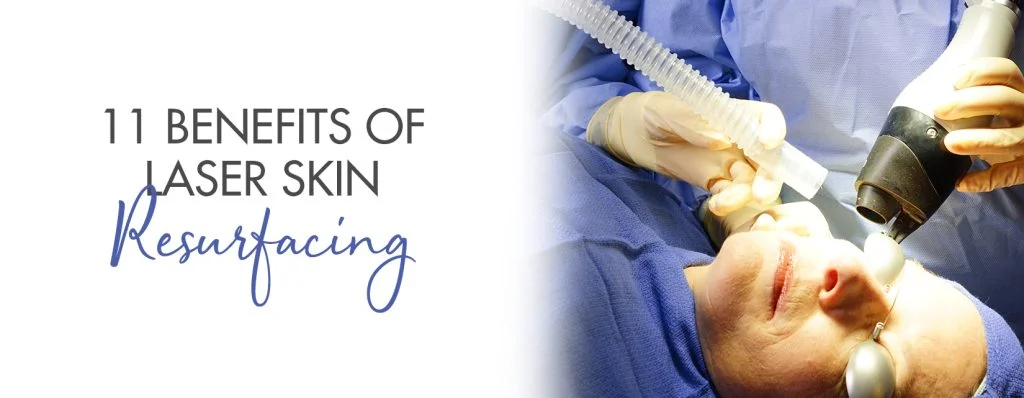 Laser skin resurfacing: Uses, benefits, risks, and cost