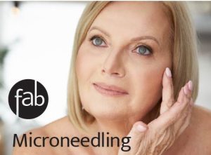 Mature lady shown to have had recent treatment with microneedling.