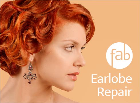 Earlobe-Repair-Atlanta-face-body